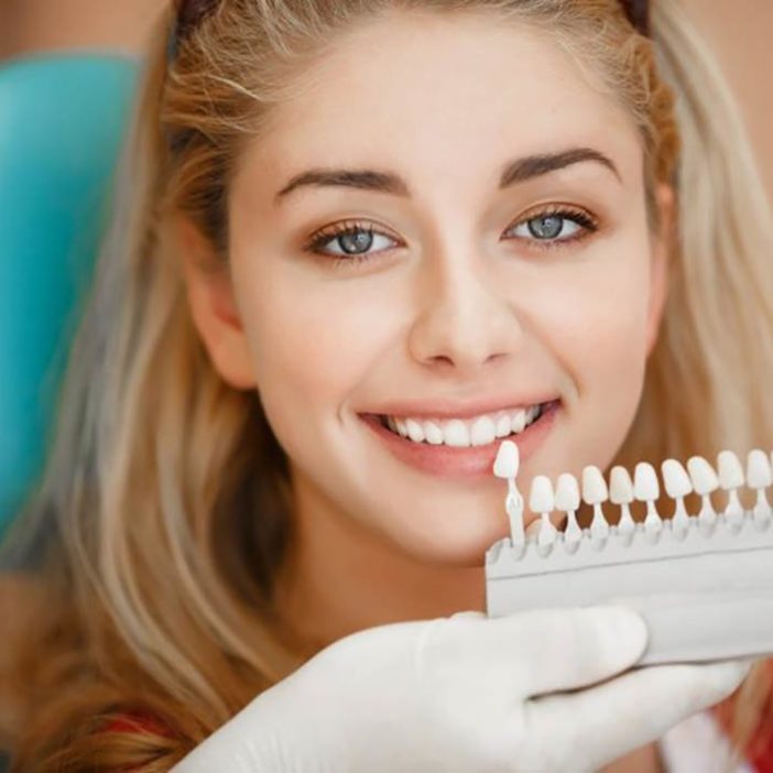 روکش های دندانی و دلایل نیاز به آنها (Dental Crowns) – قسمت دوم