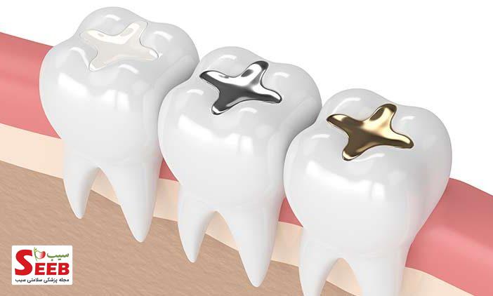 درمان مجدد ریشه دندان