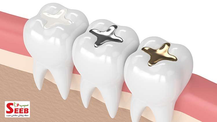 درمان مجدد ریشه دندان