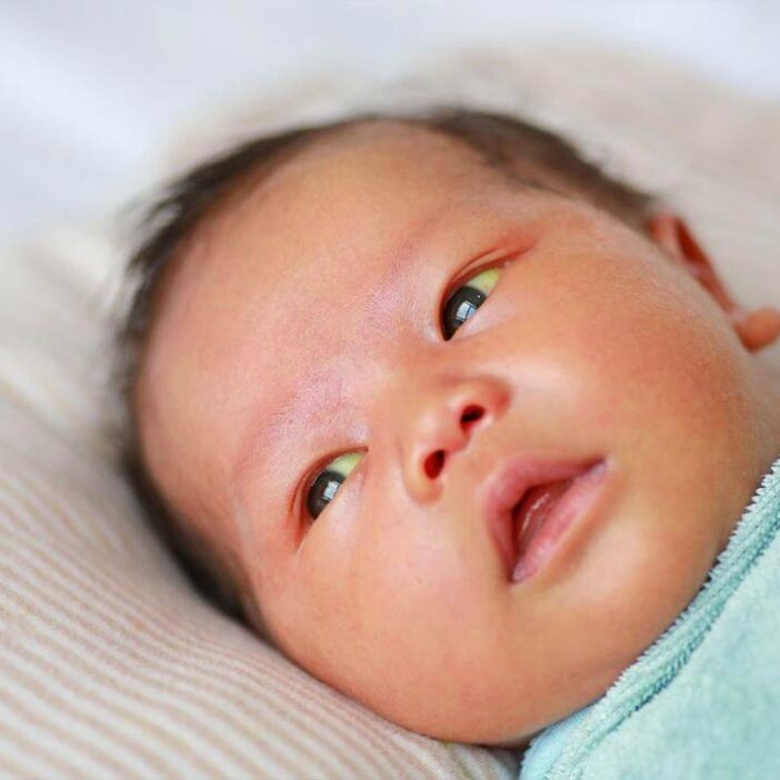 غلبه بر موانع شیردهی در نوزادان مبتلا به زردی