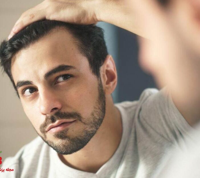 علل ریزش مو و راه کار های درمانی و اصلاح تغذیه در ریزش مو