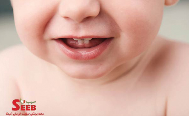 دندان در اوردن کودک ازفک بالا