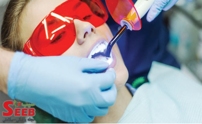 کاربرد لیزر در دندان پزشکی چیست و چه مزایایی دارد؟