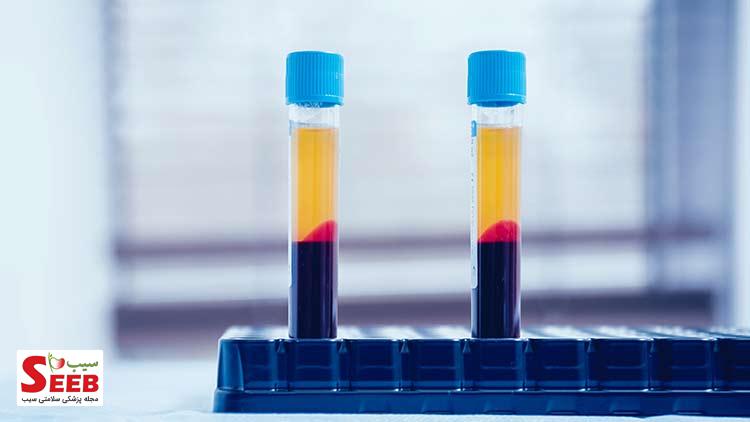 بهترین راه درمان پلاکت خون پایین درمان پلاکت خون پایین