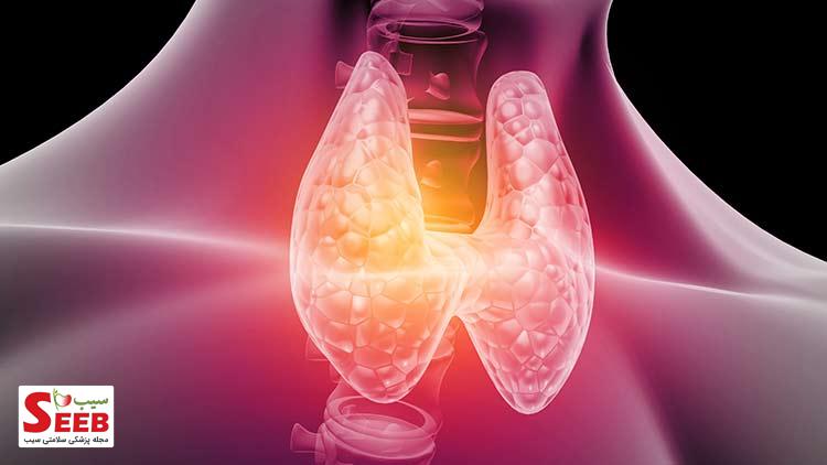 علائم تیروئید عصبی چیست؟ علائم تیروئید پرکار عصبی