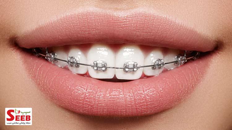 ارتودنسی دندان چه فایده ای دارد