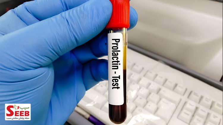 نقش هورمون پرولاکتین در بدن چه مقدار پرولاکتین خطرناک است