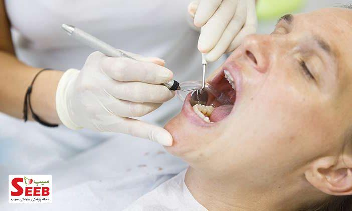 درمان ریشه دندان چطور است؟