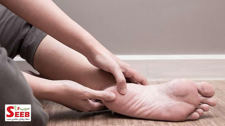 درمان رسوب کلسیم در پاشنه پا