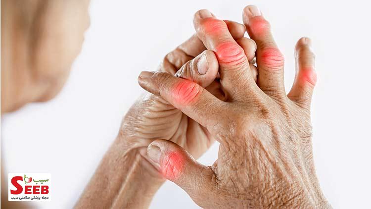 کاهش علائم بیماری آرتروز آرتروز - Arthritis