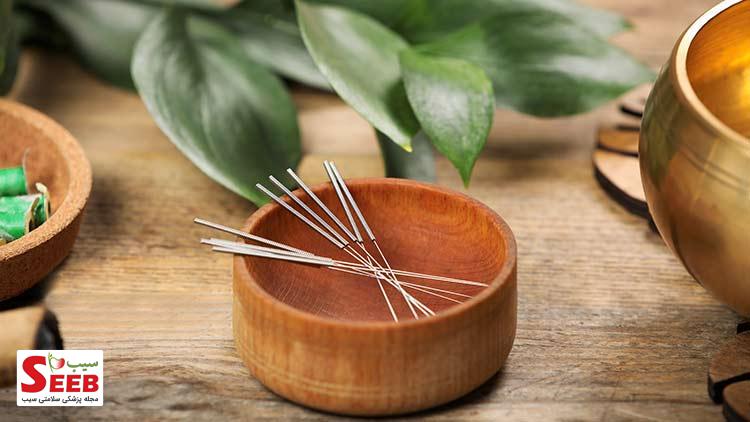 طب سوزنی acupuncture طب سوزنی