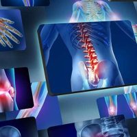 التهاب حاد چیست و علائم آن کدام است؟