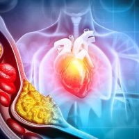 کلسترول بالا چیست و چه عوارضی دارد؟