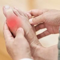 بیماری نقرس چیست و چگونه درمان میشود؟